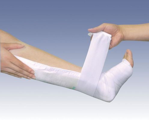 Excellent Ventilation Medical Bone Fracture Molding Orthopedic Fiberglass Casting Splint
